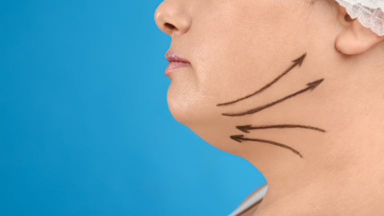 Il profilo di una donna con doppio mento e delle frecce disegnate sul volto